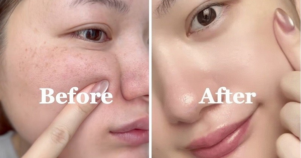 +7 kem mờ nám đậm màu 2 bên gò má đang cháy hàng, muốn mua cũng khó