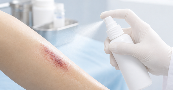 Xu hướng chăm sóc vết thương bằng sản phẩm xịt không gây xót