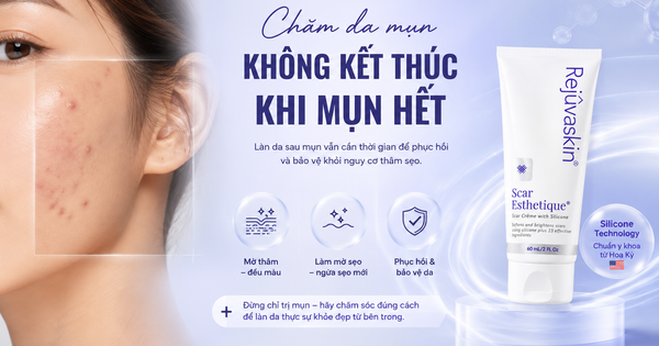 Chăm da mụn không kết thúc khi mụn hết