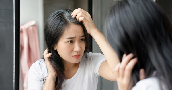 Tóc bạc trước tuổi 35: Những nguyên nhân ít ai ngờ