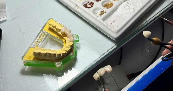 33 cơ sở sản xuất răng giả bị xử phạt