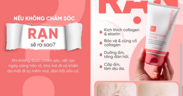 Kem xóa mờ rạn da nào hiệu quả với rạn da trắng - Chuyên gia nói gì?