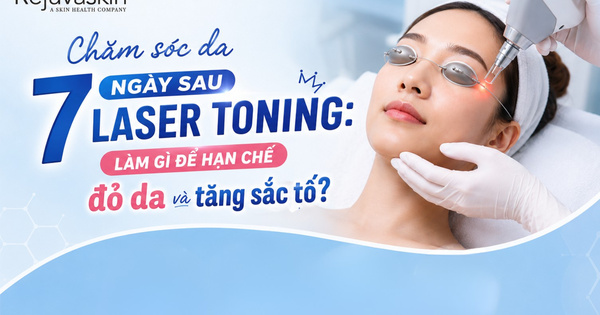 Chăm sóc da 7 ngày sau Laser Toning: Làm gì để hạn chế đỏ, tăng sắc tố?