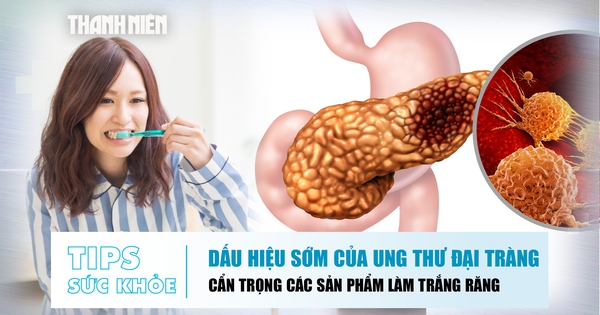 Bản tin sức khỏe 2.9: Dấu hiệu của ung thư đại tràng | Cẩn trọng sản phẩm làm trắng răng