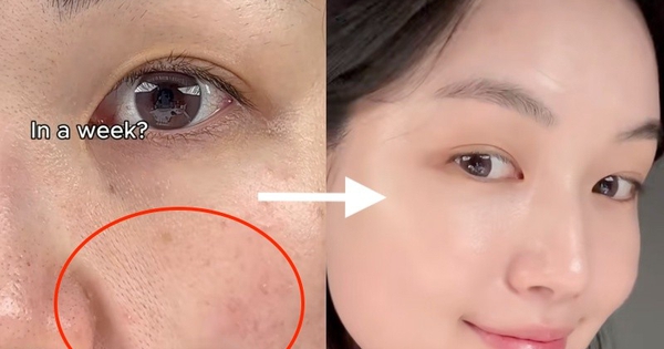 +3 kem retinol khiến chị em giật mình vì da căng bóng glowy, muốn già cũng khó