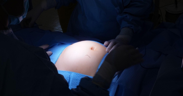 Ngỡ béo bụng, người phụ nữ 30 tuổi phát hiện 28 nhân xơ tử cung