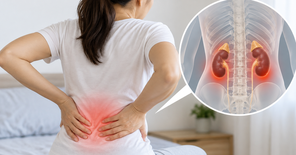 Đau lưng: Phân biệt đau do thận với đau thông thường