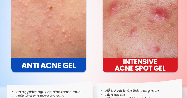 Gel chấm mụn Trioderma hiệu quả với loại mụn nào mà giới skincare đua nhau tìm mua?