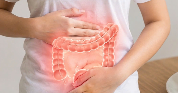 Thói quen giúp giảm nguy cơ ung thư đại tràng
