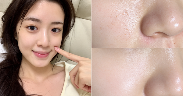 Da 30+ muốn căng bóng như tuổi 25: +5 serum chống lão hóa giúp da căng bóng