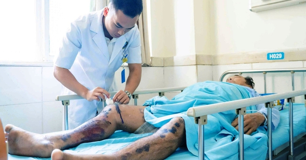 Sau hành trình sinh tử trên biển, 3 ngư dân tiếp tục điều trị tại bệnh viện