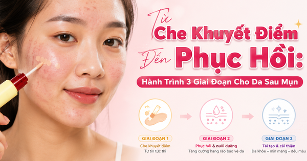 Từ che khuyết điểm đến phục hồi: Hành trình 3 giai đoạn cho da sau mụn