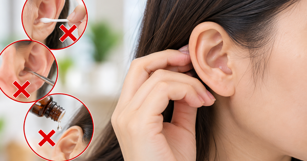 Bác sĩ: Người bình thường không cần lấy ráy tai theo lịch cố định