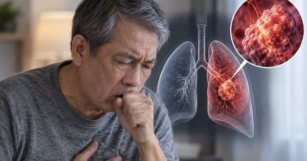 4 dấu hiệu kéo dài trên cơ thể có thể do ung thư