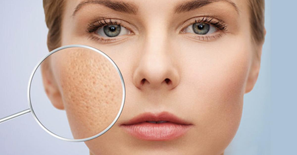 Lời khuyên về lựa chọn sản phẩm chăm sóc da phù hợp cho người có tình trạng mụn rỗ ở mũi.