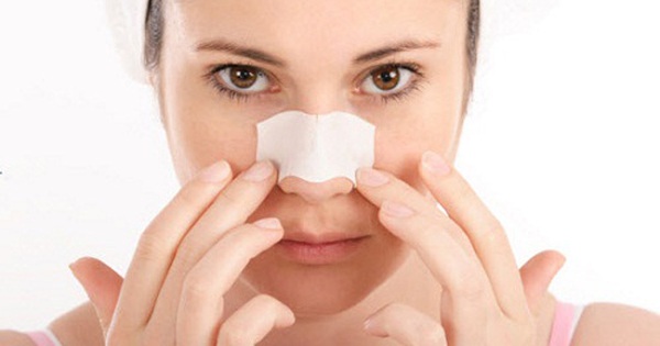Có những biện pháp phòng ngừa nào để không tái phát sẹo mụn ở mũi sau khi được điều trị?
