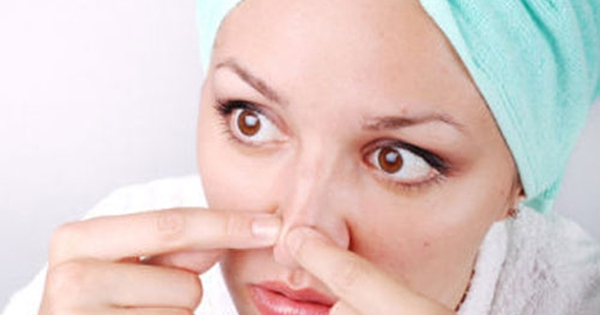 10 cách trị mụn đầu đen ở mũi bằng chanh hiệu quả và dễ thực hiện