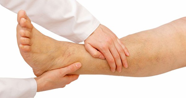Các nguyên nhân bị đau chân phổ biến và cách điều trị