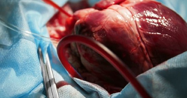 Tại sao tim đập nhanh và mạnh cần được điều trị sớm?
