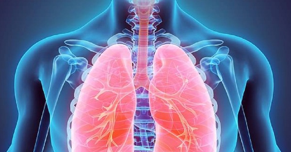 Ho ra máu có thể là dấu hiệu của những bệnh phổi nào khác?
