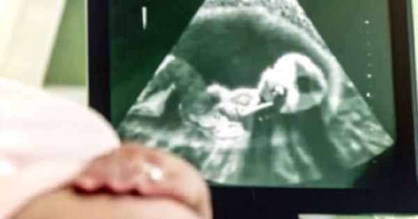 Quy tắc để phân biệt giới tính thai nhi dựa trên hình ảnh siêu âm là gì?
