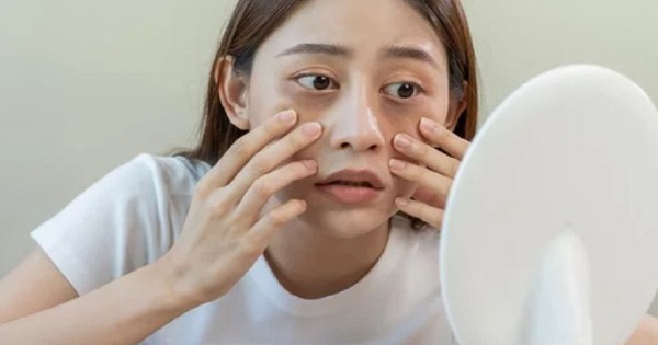 Những nguyên nhân gây viêm xoang gây sưng mặt và cách điều trị hiệu quả