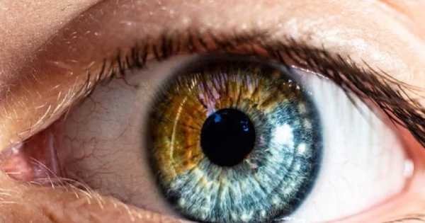 Sưng mí mắt sau khi ngủ dậy có thể là triệu chứng của một bệnh lý nào đó?
