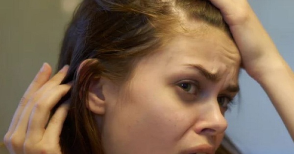  Mụn mọc ở trán gần chân tóc : Nguyên nhân và cách phòng tránh mụn