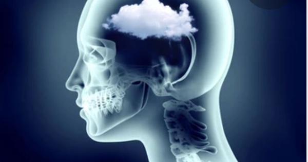 Nguyên nhân gây ra sương mù não là gì?
