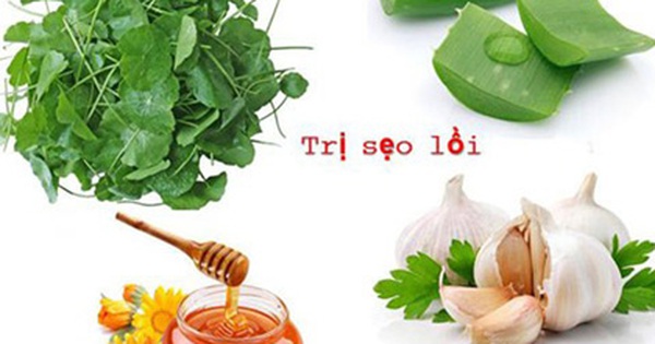 Mổ nội soi ruột thừa có để lại sẹo không?
