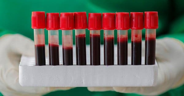 Những người mang nhóm máu AB có nguy cơ mắc bệnh ung thư thực quản cao hơn so với nhóm máu O?
