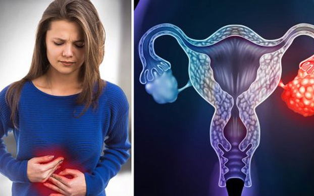Ung thư buồng trứng: Nguy cơ gây bệnh và cách đề phòng?