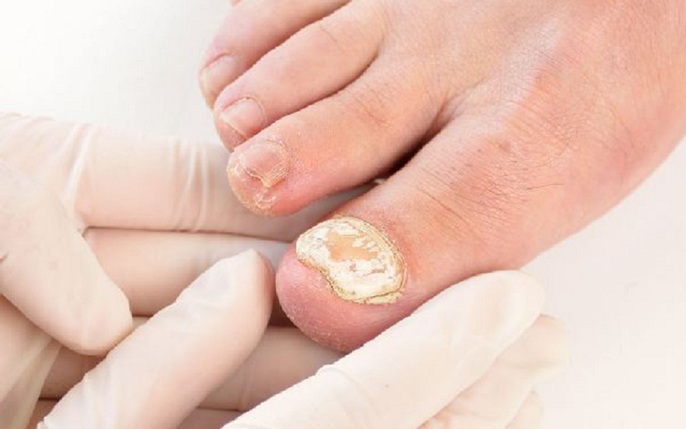 1000 Mẫu nail chân HOT siêu đẹp được nhiều chị em lựa chọn