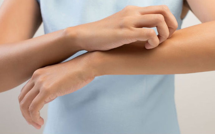 Bệnh eczema: tin tức, hình ảnh, video, bình luận mới nhất