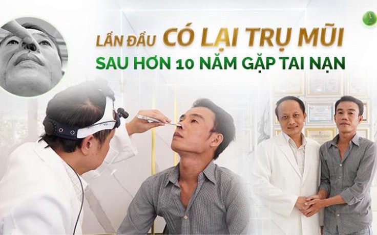 Có lại trụ mũi sau hơn 10 năm gặp tai nạn