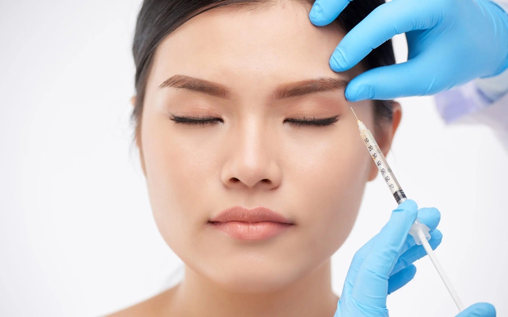 Những vết chân chim ở mắt và điều cần biết khi xóa nếp nhăn bằng botox