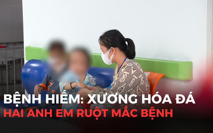 Xương hóa đá: Bệnh hiếm gặp chưa có phương pháp điều trị dứt điểm