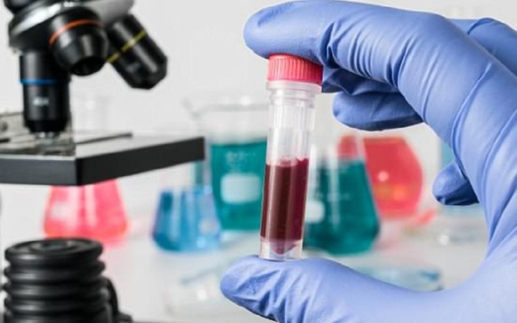 4 loại xét nghiệm máu quan trọng nên thực hiện khi khám sức khỏe định kỳ