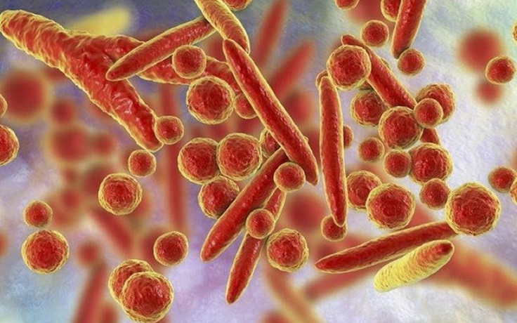Viêm phổi tăng ở trẻ em nhiều nước: Cảnh giác với vi khuẩn mycoplasma Viêm phổi tăng ở trẻ em nhiều nước: Cảnh giác với vi khuẩn mycoplasma