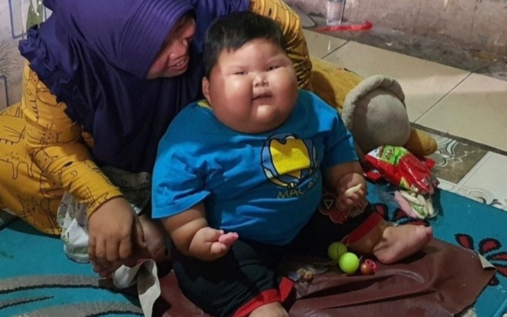 Chuyện lạ: Em bé 16 tháng tuổi đã nặng 27 kg