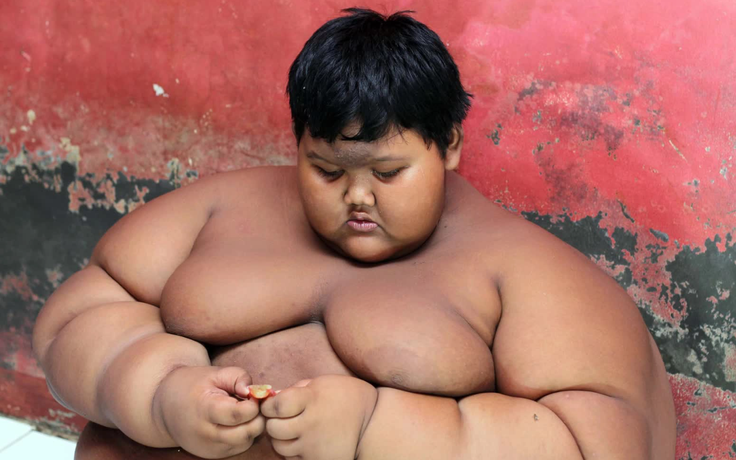'Cậu bé béo nhất thế giới' bây giờ ra sao?