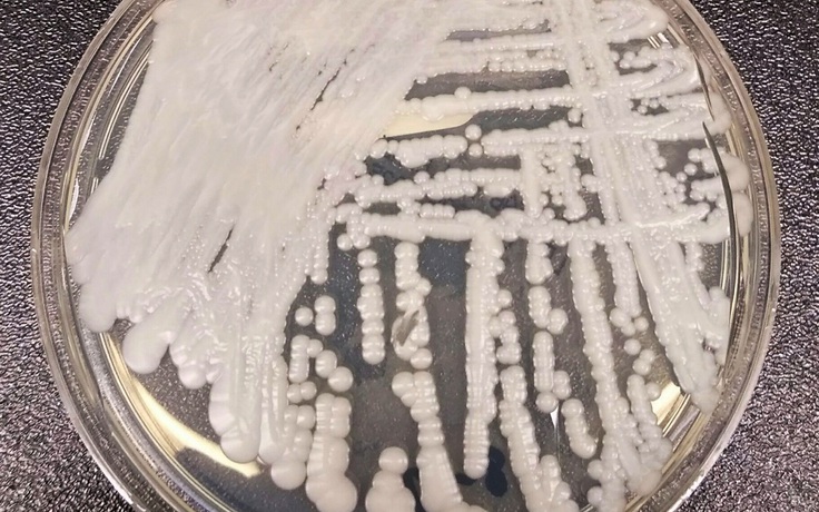 Mỹ báo động vì loại nấm chết người lây lan trong bệnh viện