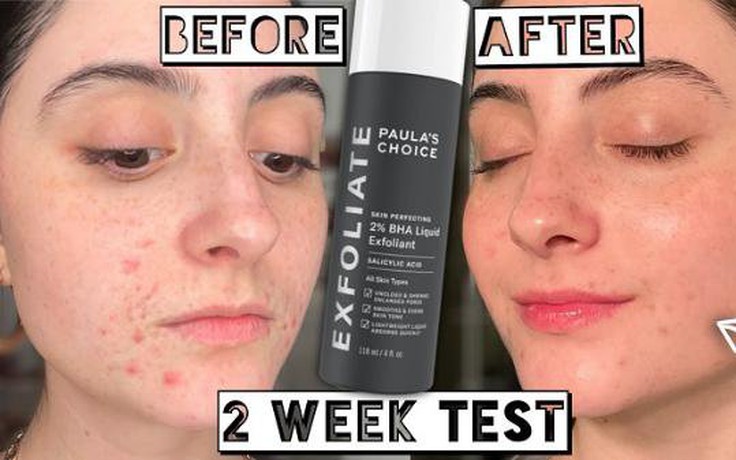 Review tẩy tế bào chết 2% BHA Paula's Choice Skin Perfecting Liquid Exfoliant