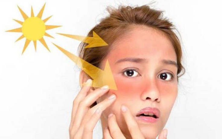 Chỉ số tia UV tăng cao nguy cơ gây hại cho sức khỏe và làn da