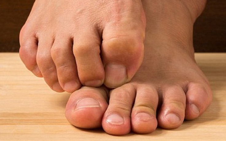 Ngày mới với tin tức sức khỏe: Vì sao ngọ nguậy ngón chân lại tốt cho tim?