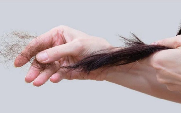 Phát hiện sớm đau tim bằng cách kiểm tra tóc Phát hiện sớm đau tim bằng cách kiểm tra tóc