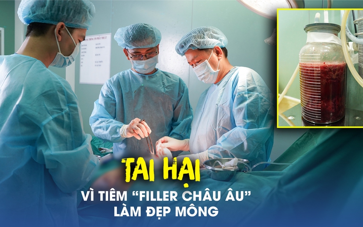 Tai hại vì tiêm ‘filler châu Âu’ làm đẹp mông, bị áp xe phải mổ 3 lần