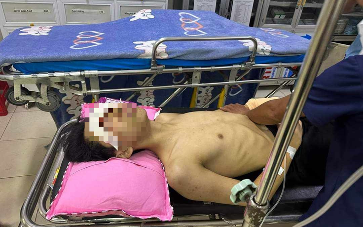 Hà Tĩnh: Nam sinh lớp 11 bị thương nghi do nổ bình gas mini