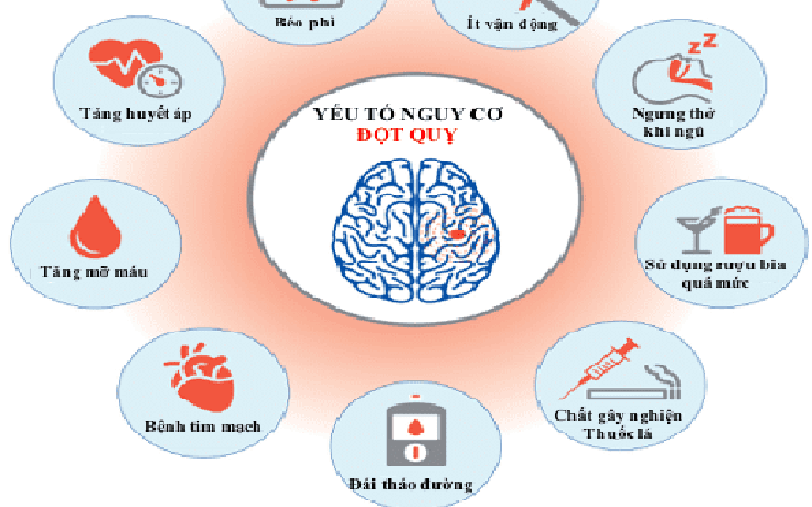 Điều trị dự phòng giúp giảm 80% nguy cơ tái phát đột quỵ