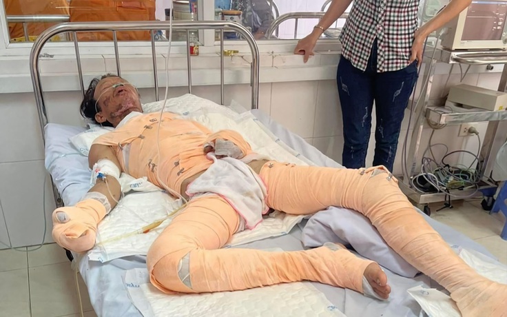 Người phụ hồ nghèo bị bỏng điện nguy kịch Người phụ hồ nghèo bị bỏng điện nguy kịch